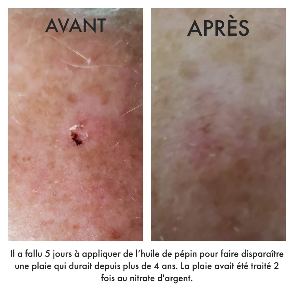 Huile de pépins pure d'argouse - 30 ml - Domaine de l'artoustil