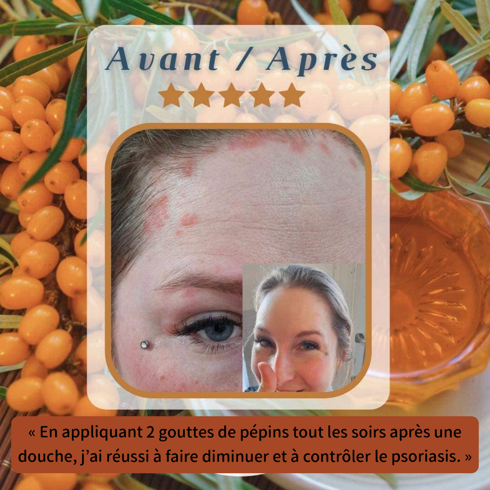 Huile de pépins pure d'argouse - 30 ml - Domaine de l'artoustil